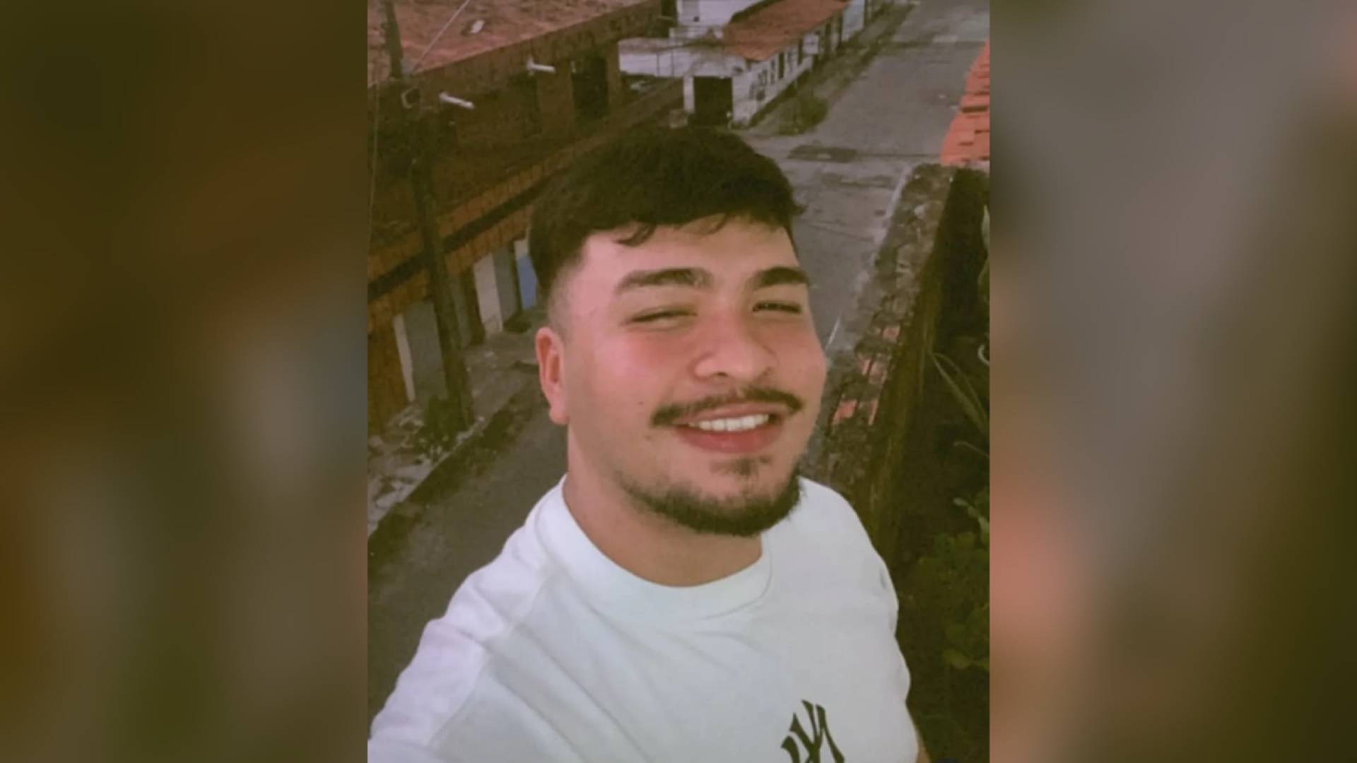 Jovem baleado na cabeça durante briga em barraca de praia segue internado em Fortaleza