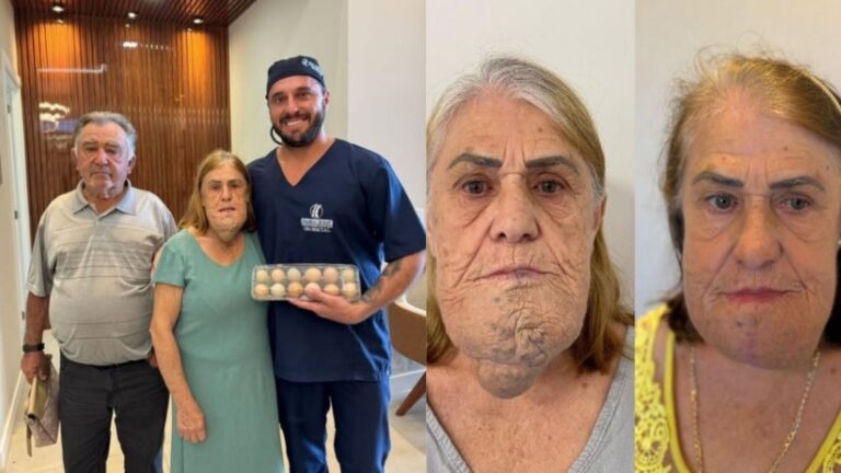 Mulher ‘paga’ cirurgia facial com ovos e galo em Santa Catarina